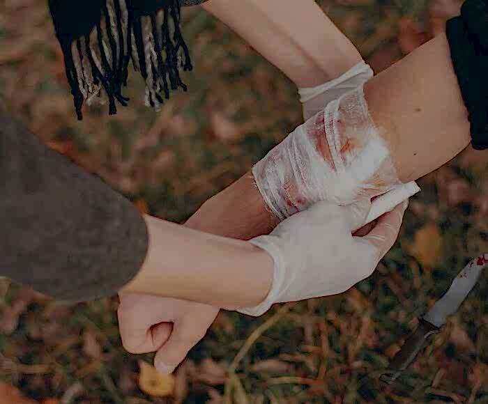 kasten yaralama suçunda yaralının elinin sarılması